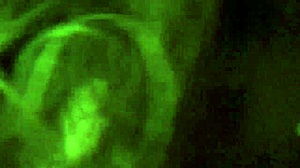 Surprise Mouth Cum Sperm Dripping From Lips