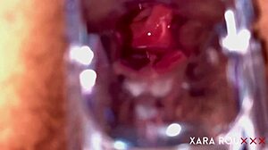 Anal vision speculum