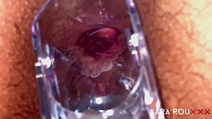 Anal vision speculum