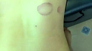 masseur says, 'bend over for doggystyle' and cums on patients' asses in hospital