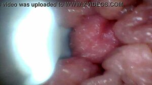 Penis Endoscope View!