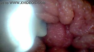 Penis Endoscope View!