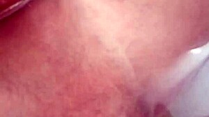 prolapse anal fisting