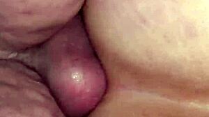 anal destruction