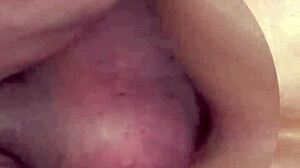 anal destruction